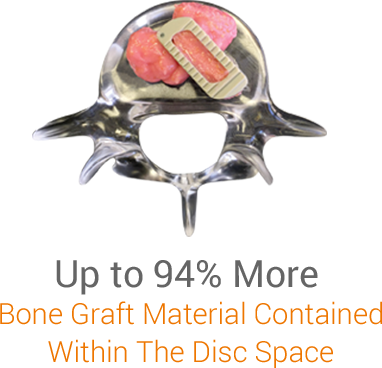 Up to 94% More Bone Graft Material Contained Within The Disc Space